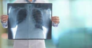 Emphysema Prognosis And Treatment Options