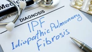 Idiopathic Pulmonary Fibrosis Stages And You