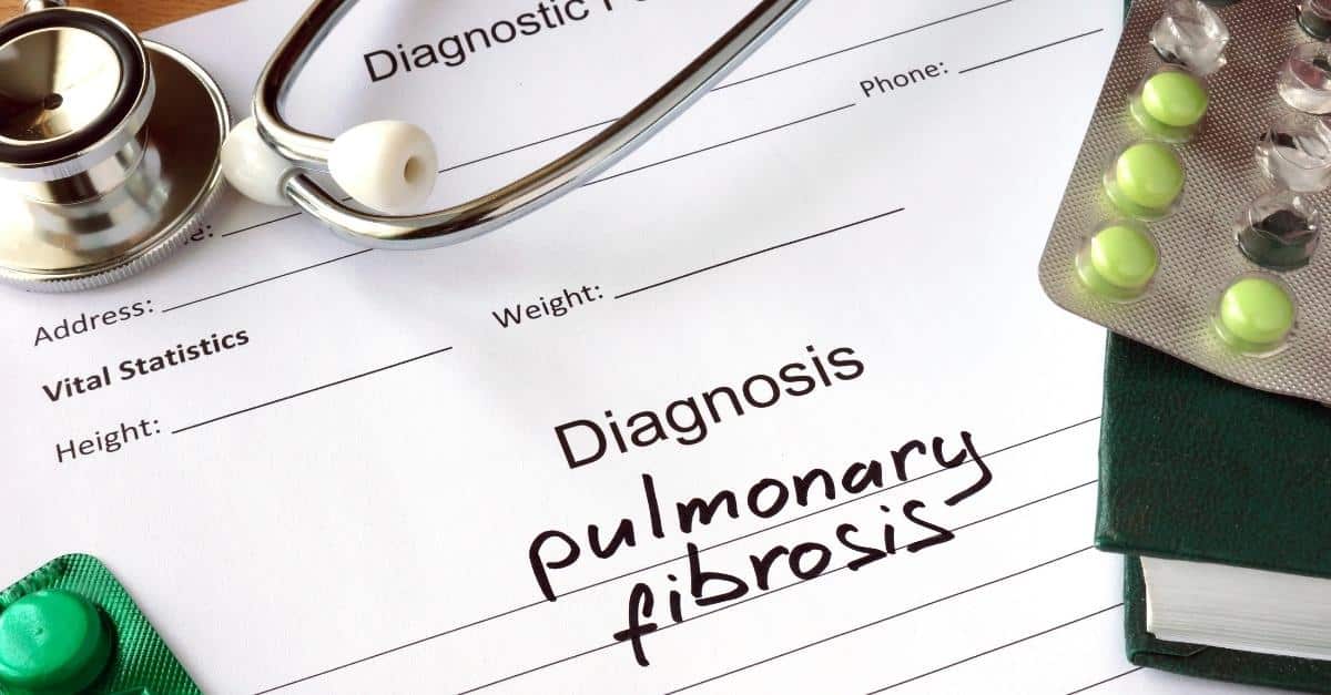 Pulmonary Fibrosis Stage 4 Symptoms