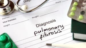 Pulmonary Fibrosis Stages